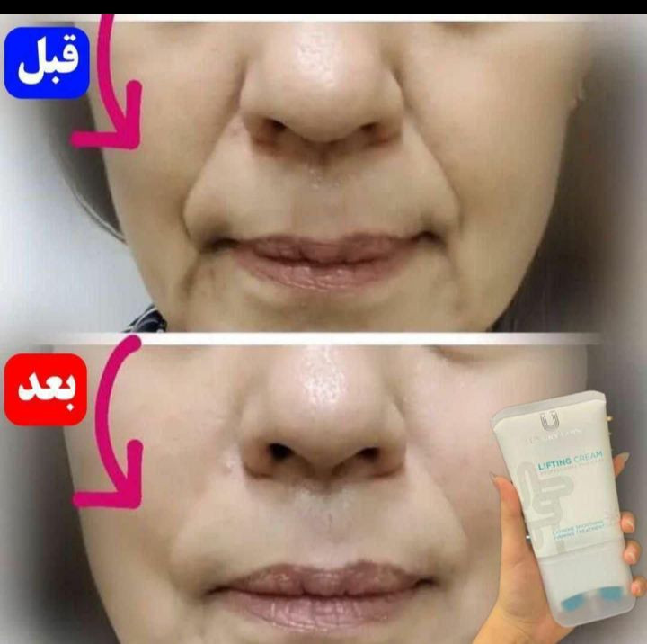 کرم جوانسازی و لیفتینگ لاکچری کوین