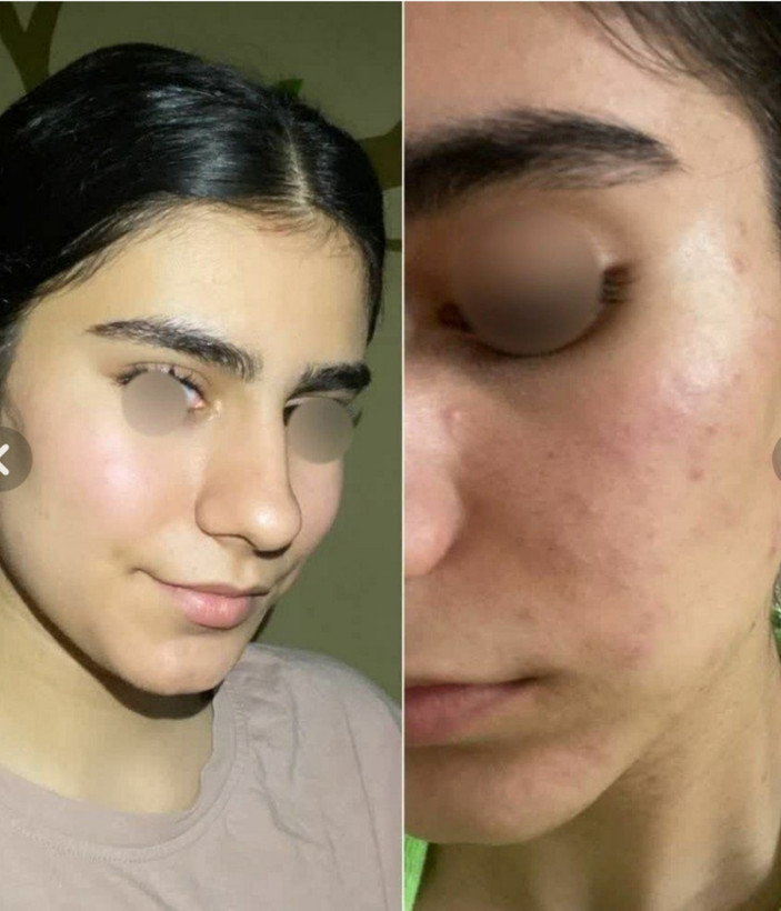کرم جوانه ی گندم ویتابلا 180میل کاسه ای اورجینال برند: ویتابلا
